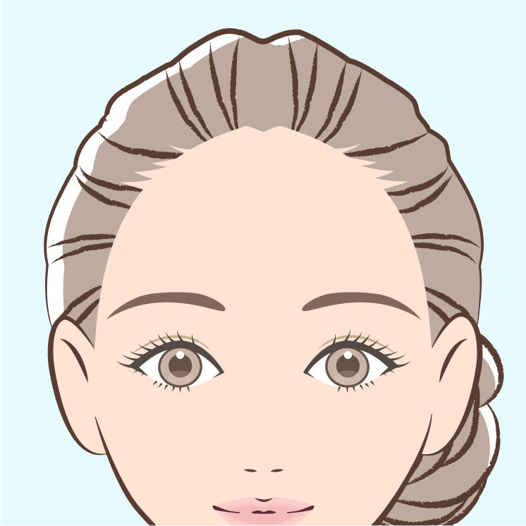 ヘアライン（生え際）