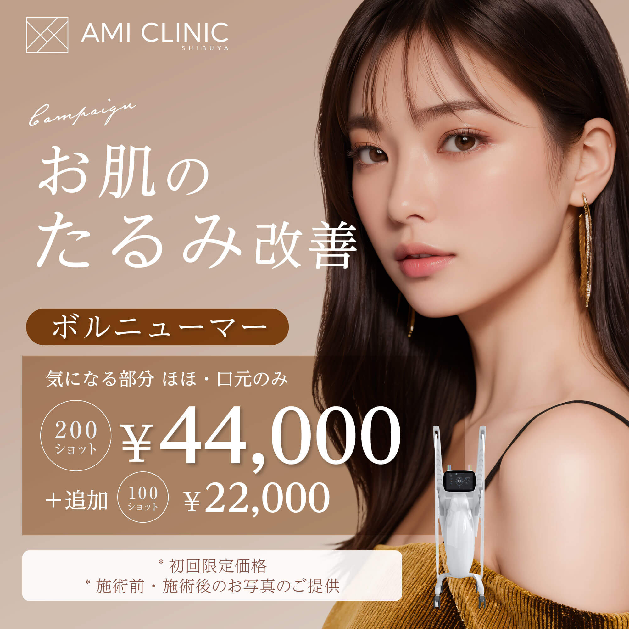 5月キャンペーン