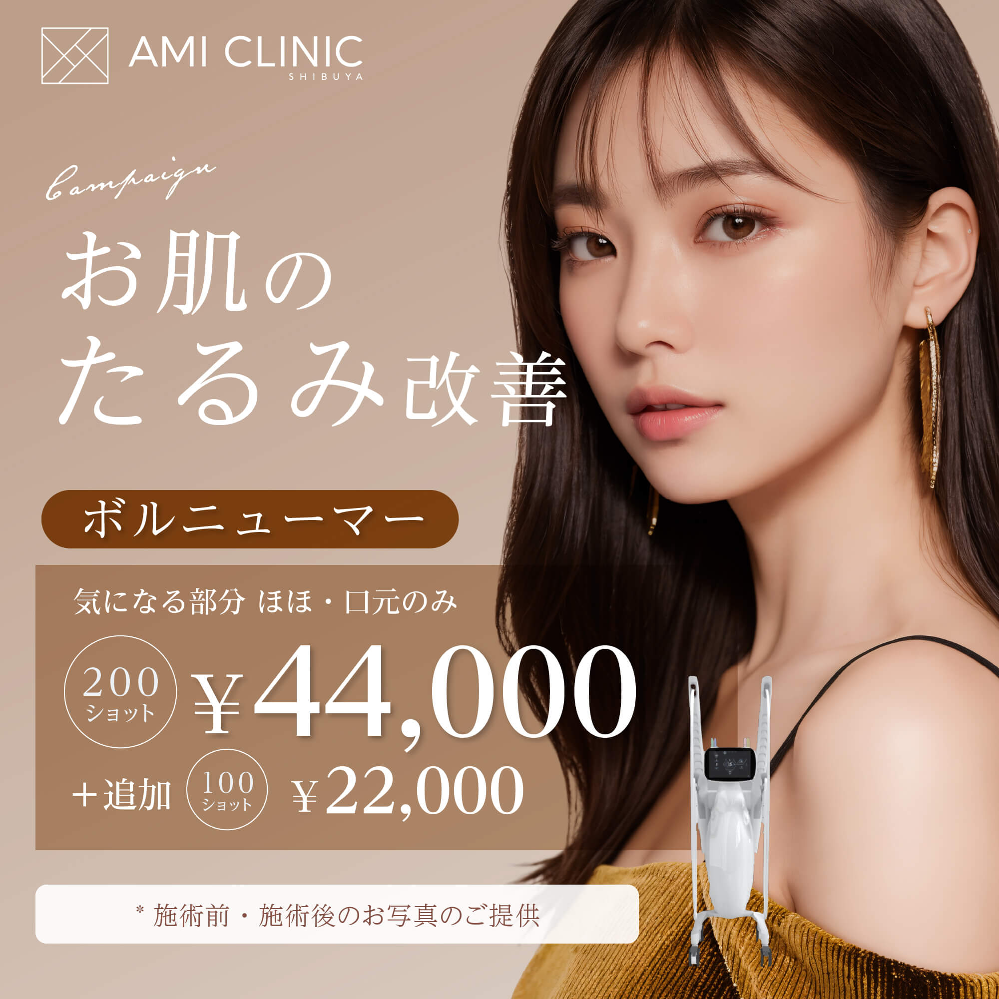 7月キャンペーン