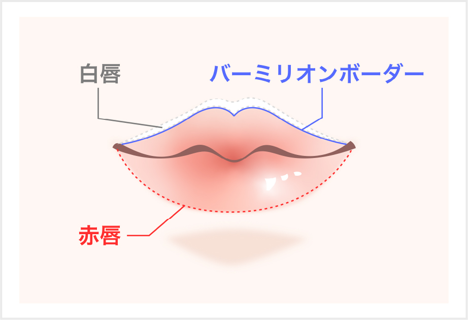 唇のヒアルロン酸注射の対象部位